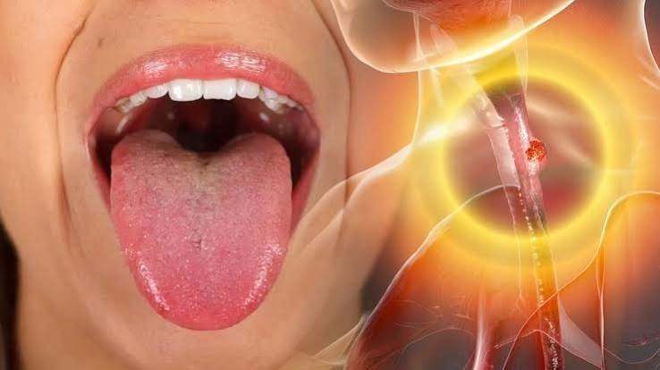 தொண்டை புண்ணிற்கு என்ன செய்யலாம் ?